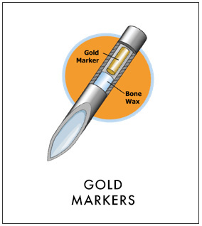 Gold Marker